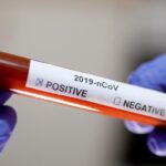 Що робити, якщо у вас симптоми COVID-19?