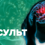 Що таке інсульт та як його розпізнати?