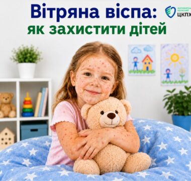 Вітряна віспа: як захистити дітей